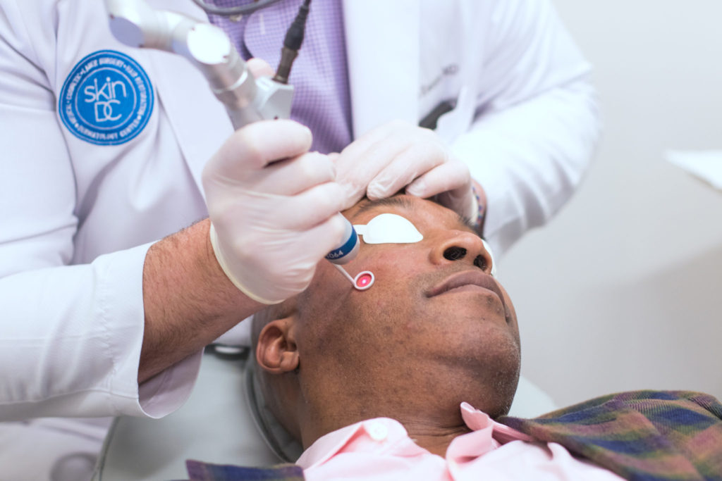 non-surgical male cosmetic treatment laser