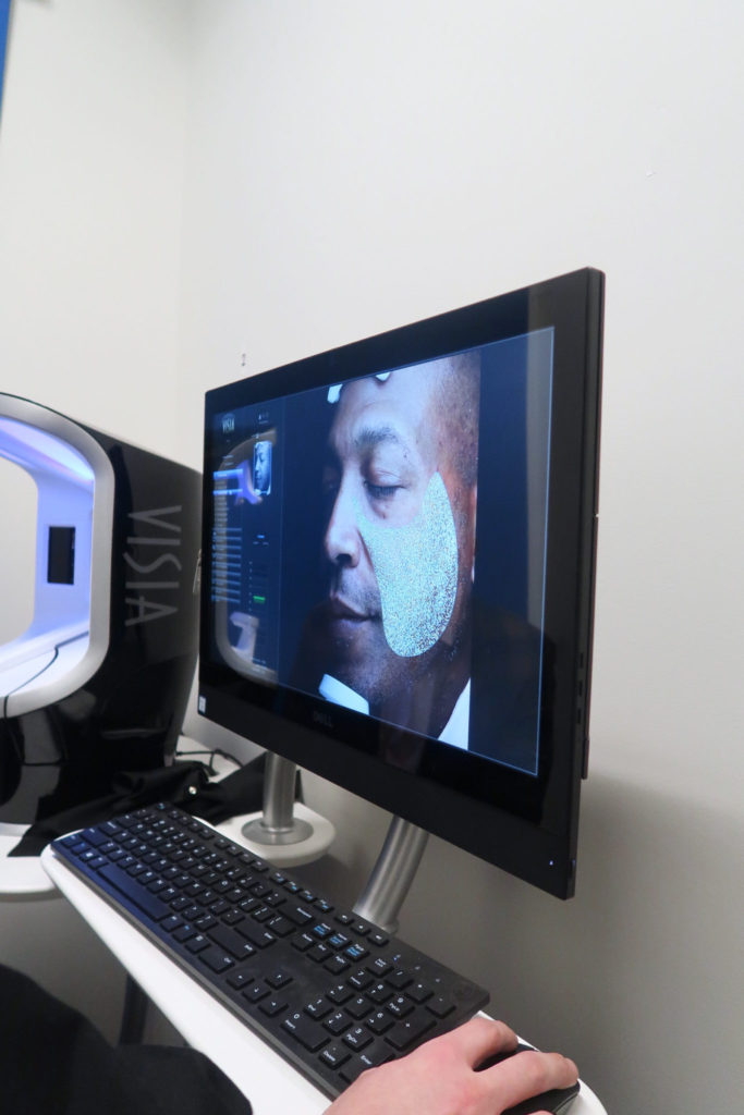 Visia skin analysis assessment - dermatologist